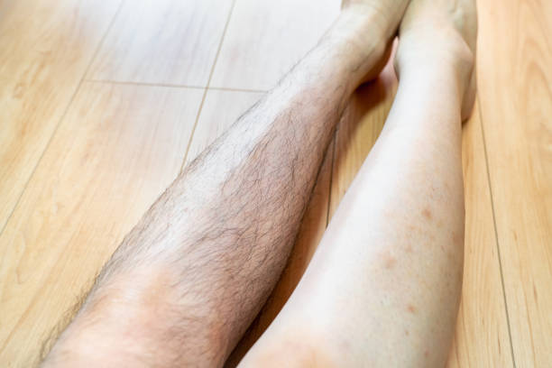 A photo of a man with shaved legs. Photos before and after shaving.