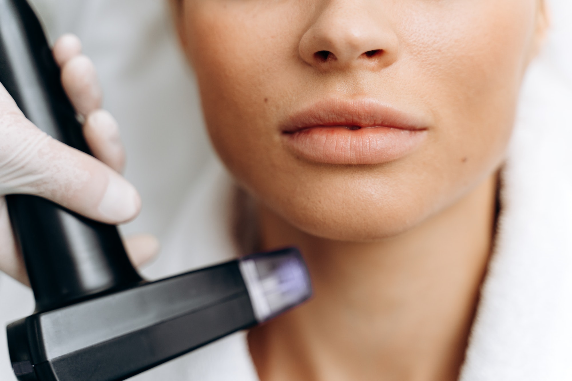 Woman in white bathrobe undergoing laser hair removal procedure on her face